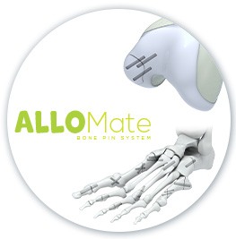 AlloMate Bone Pin System