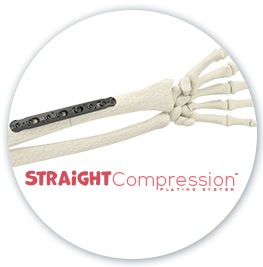 Straight Compression Plating System